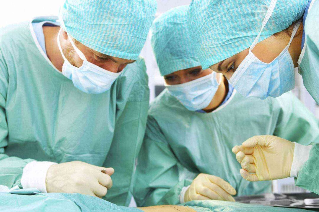 Penis enlargement surgery and its photo price 3