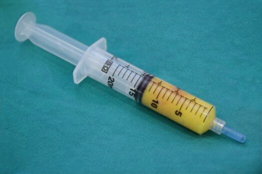 Adipose tissue syringe for lipofilling