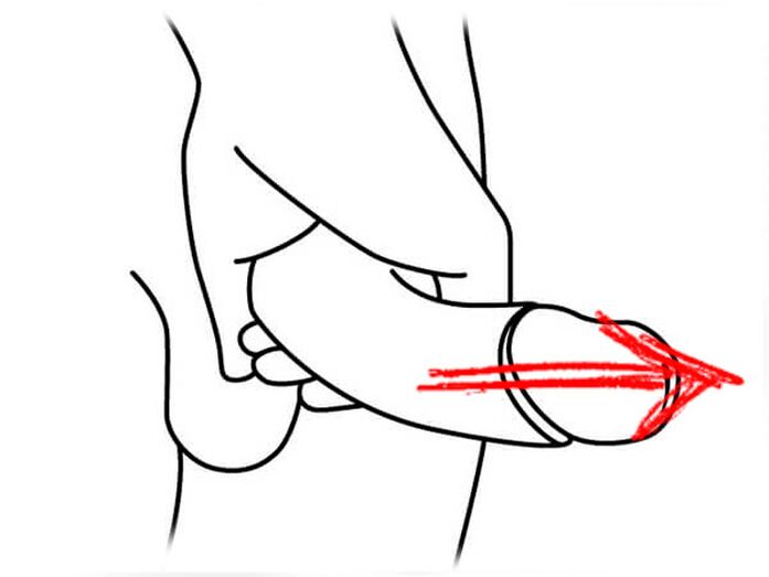 The extension of the penis for enlargement